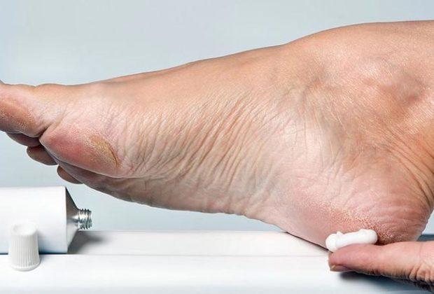 Les meilleures crèmes pour les talons fissurés selon les avis des clients La meilleure crème pour les talons craquelés