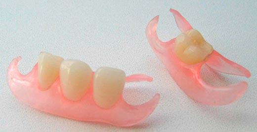 Prothèses amovibles en nylon