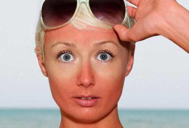 Les meilleurs remèdes contre les brûlures selon les avis des clients Les meilleurs remèdes contre les brûlures