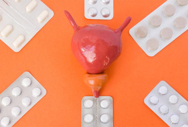 Les meilleurs remèdes contre la cystite Les meilleurs remèdes contre la cystite