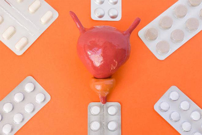 Les meilleurs remèdes contre la cystite Les meilleurs remèdes contre la cystite