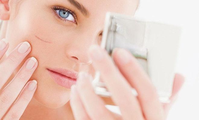 Les meilleurs remèdes pour les cicatrices et les cicatrices Les meilleurs remèdes pour les cicatrices et les cicatrices