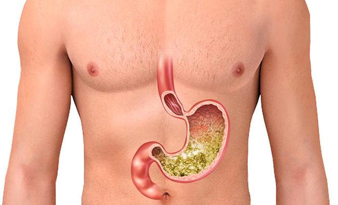 Les meilleurs absorbants Les meilleurs absorbants