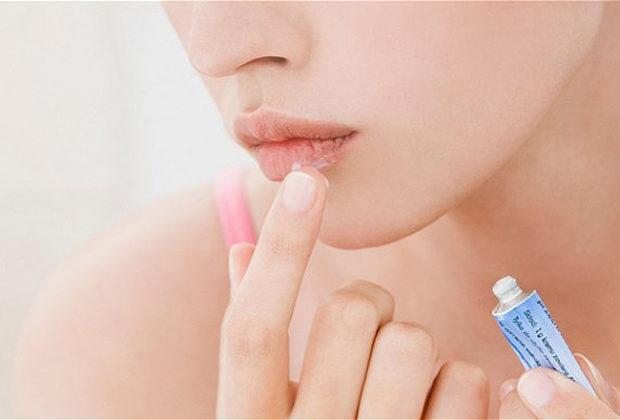 Les meilleurs remèdes contre l'herpès Les meilleurs remèdes contre l'herpès