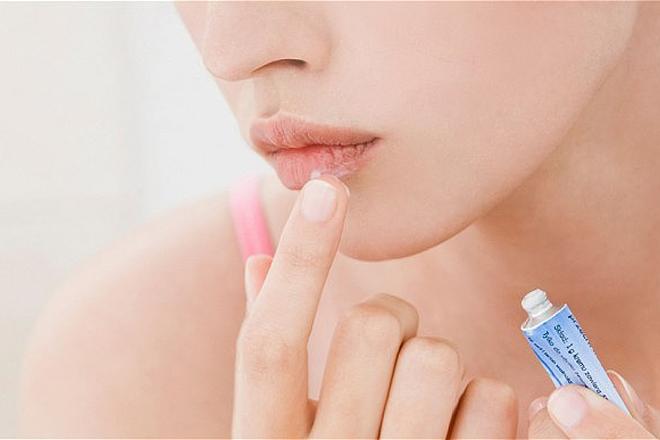 Les meilleurs remèdes contre l'herpès Les meilleurs remèdes contre l'herpès